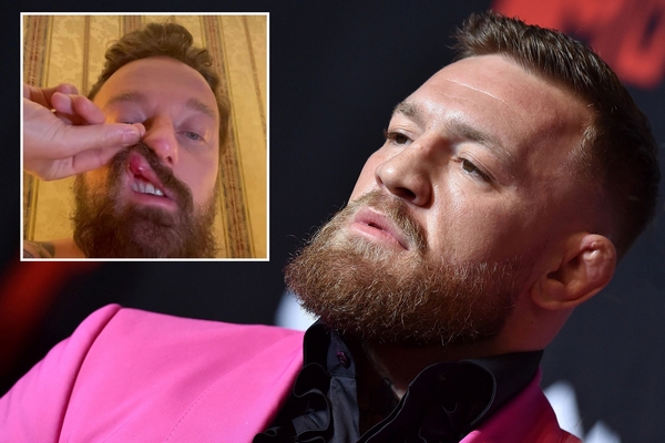 conor mcgregor utok