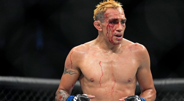 tony ferguson