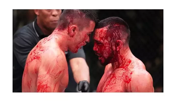 UFC zápasník bojoval s přetrženou tepnou: Lékaři mi řekli, že jsem ztratil 20 % krve!