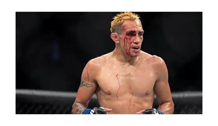 Proč Tony Ferguson i navzdory stále horším výkonům nehodlá končit kariéru?