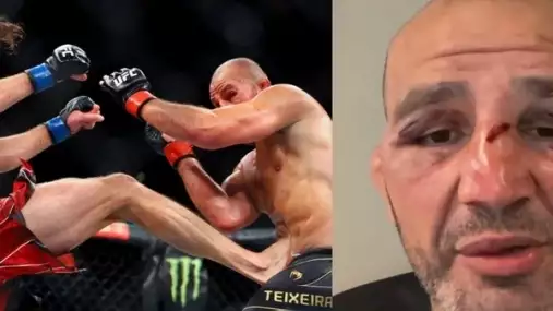 Teixeira popsal, v čem konkrétně nejvíce Procházku podcenil