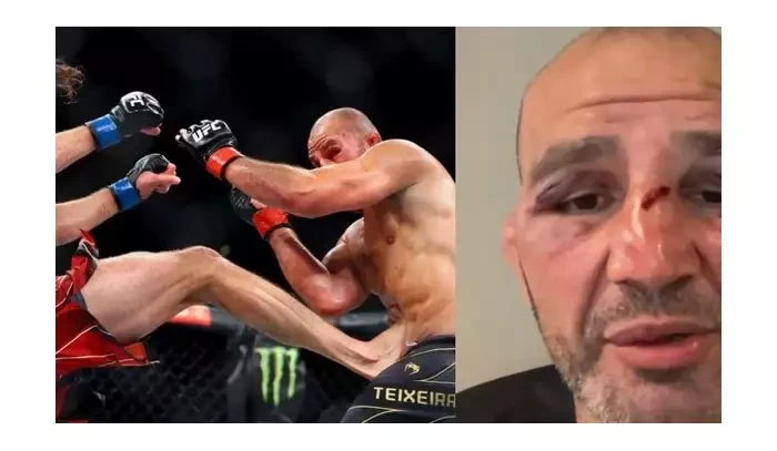 Teixeira popsal, v čem konkrétně nejvíce Procházku podcenil