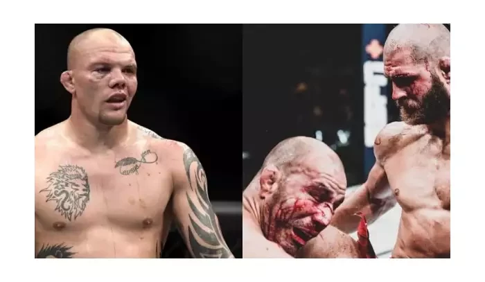 Anthony Smith pokračuje v útoku na Procházku: Nejhorší výkon života!