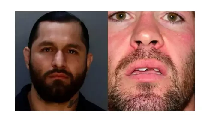 Takto vypadal Covington po útoku Masvidala. Vyražený zub, otřes mozku a psychické trauma