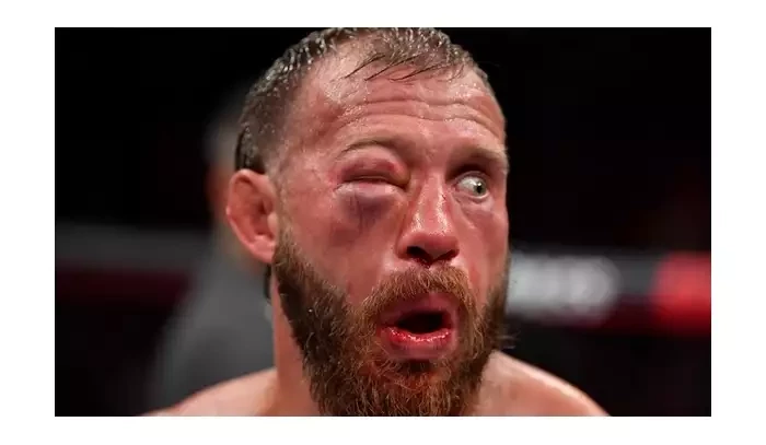 Cowboy Cerrone: Jsem úplně v p*deli, ale na konec ještě myslet nechci