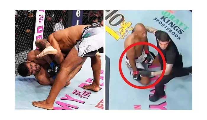 Video: Jacare Souza musí po děsivém zranění na operaci. Kost se zlomila nad loktem, říká