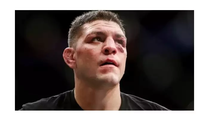 Nick Diaz má domluveného dalšího soupeře, prozradil UFC veterán. Vrátí se zpátky do veltru