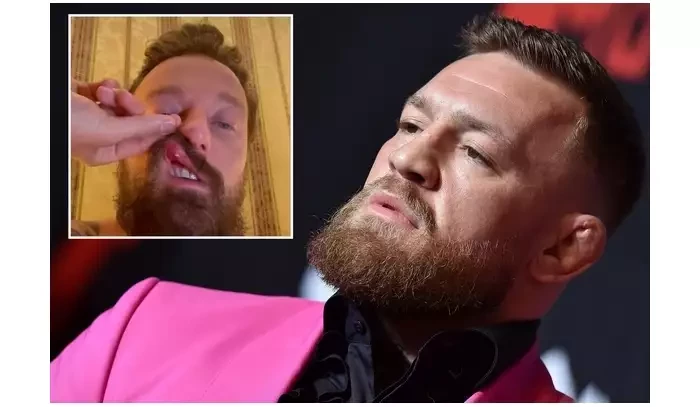 Nepoučitelný Conor McGregor má za sebou další napadení a ublížení na zdraví