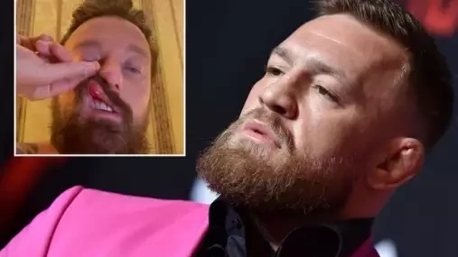Nepoučitelný Conor McGregor má za sebou další napadení a ublížení na zdraví