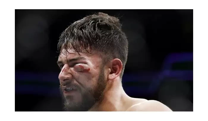 Smolař Rodriguez je opět bez soupeře, Holloway se zranil a UFC shání nový hlavní zápas večera