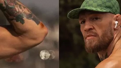 Conor McGregor vyděsil fanoušky! Že by měl infekci? ptají se ho. Ir odpověděl