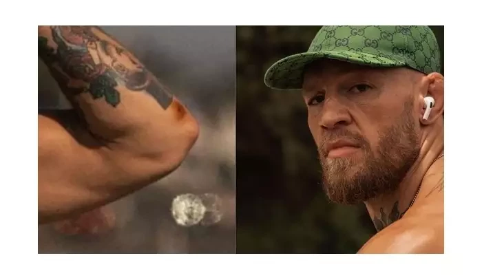 Conor McGregor vyděsil fanoušky! Že by měl infekci? ptají se ho. Ir odpověděl
