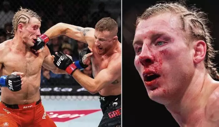 Dvě stovky ran a Paddy stále stojí: Liverpoolská brada šokovala i šéfa UFC