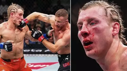 Dvě stovky ran a Paddy stále stojí: Liverpoolská brada šokovala i šéfa UFC