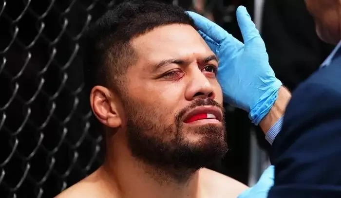 Video: UFC Fight Night přineslo ošklivé zranění oka! Justin Tafa chtěl pro soupeře diskvalifikaci