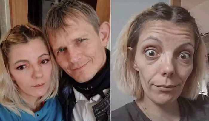 Vězení na krku a parohy na hlavě! Adély letitý milenec má vážné potíže se zákonem. Oba se podvádí a společně léčí kvasinky Imazolem