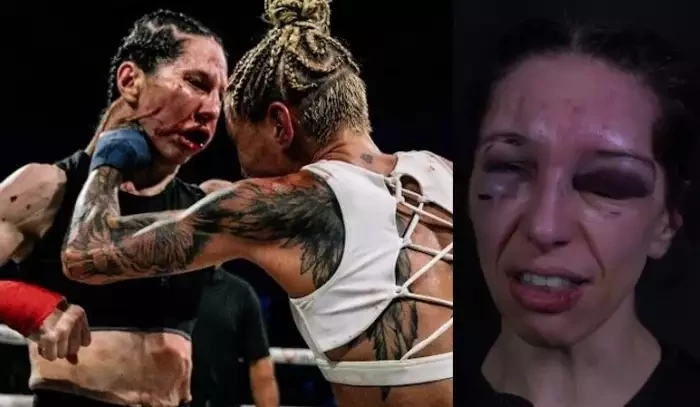 Jako by ji přejel vlak! Bojovnice z boxu bez rukavic je teď bez zubů. Rozhodčí čelí kritice, že nezvládl svoji práci