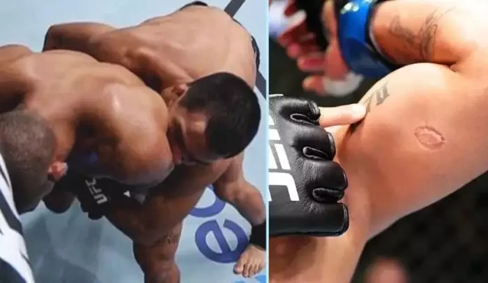 VIDEO: Nevšední ukončení zápasu v UFC! Bojovník se jako vzteklý pitbull zakousl do svého soupeře